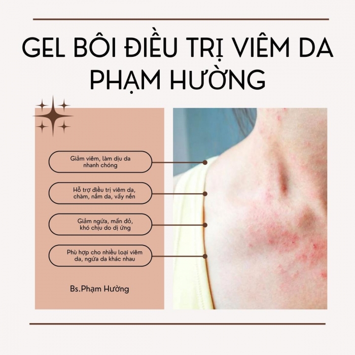 Gel bôi điều trị viêm da, mụn lưng hiệu quả giảm ngứa - Phạm Hường